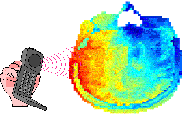 Figure 2, Exposure of the Brain